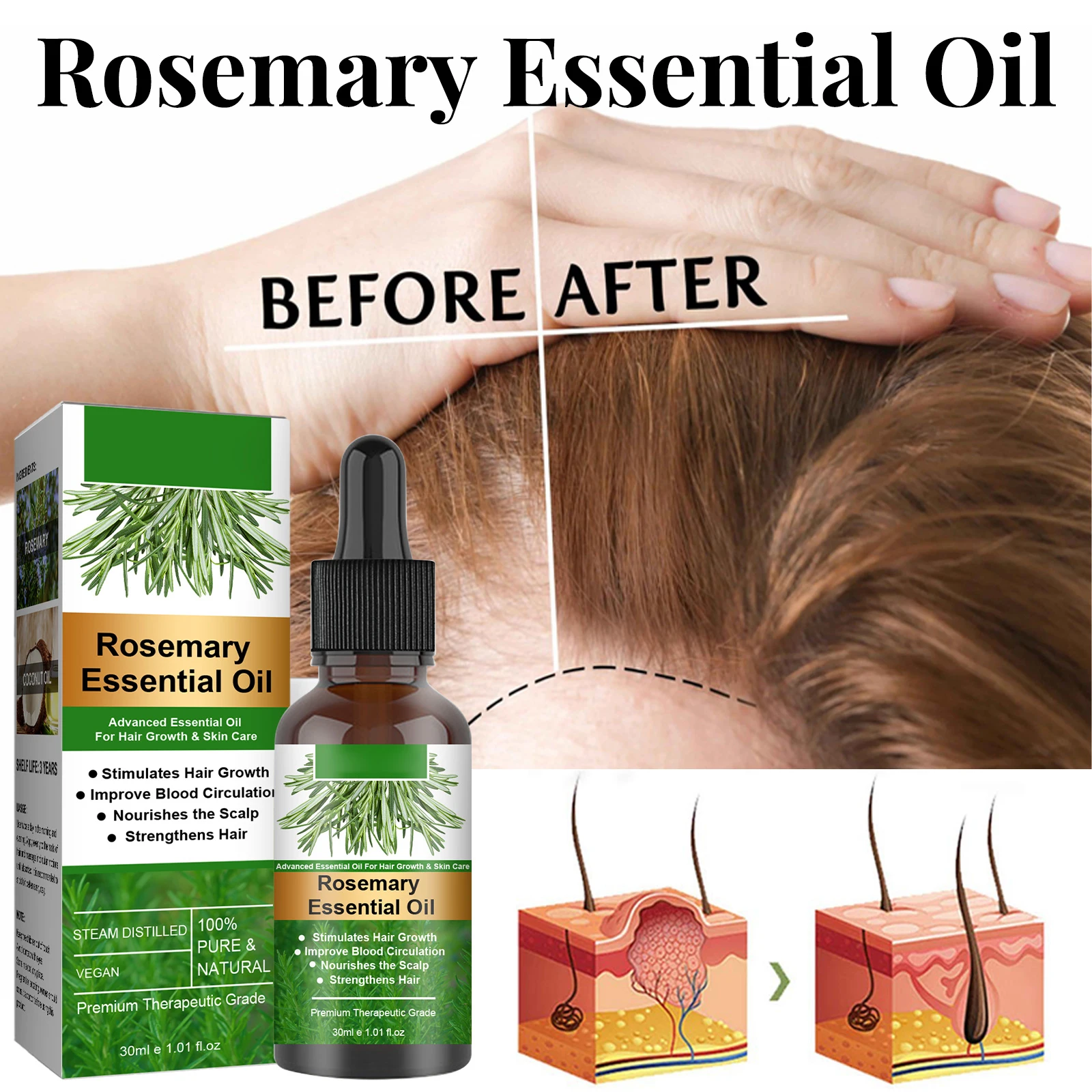1 Set 30ml Women Men Rosemary Essential Oil Hair Tonic Stimulates Hair  Growth Nourishment Hair Follicles Care Anti Hair Loss - Hair Loss Product  Series - AliExpress