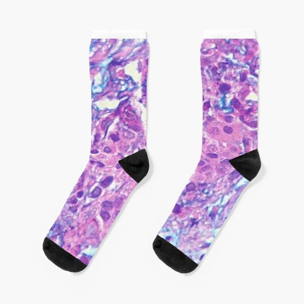 Mucoepidermoid carcinoma Socks aesthetic crazy Heating sock man Socks Woman Men's