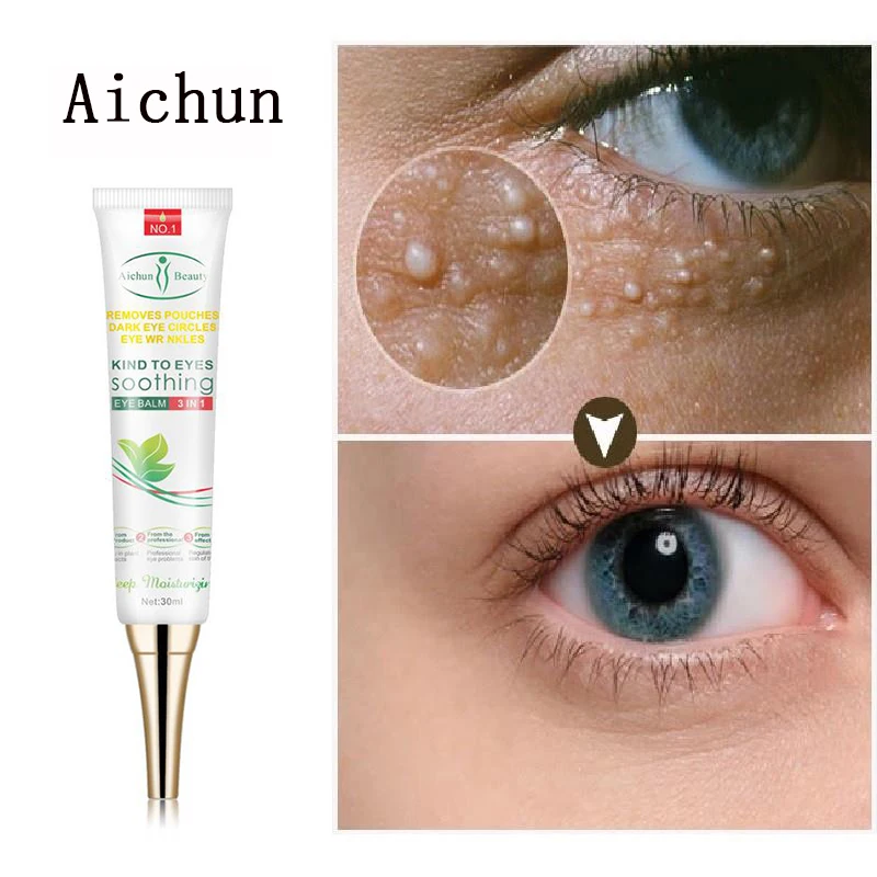 fat granules remover eye cream effective remove fat granules puffiness anti particles milia remover product repair eye skin care Effective Remove Fat Granules Eyes Cream Fade Fine Lines Eye Bags Vitamin E Anti-Wrinkle Firming Anti Dark Circle Eye Skin Care