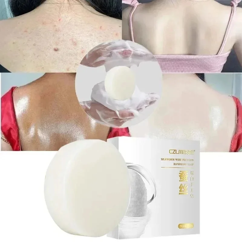Body Whitening Soap Underarm Knee Bleaching Chicken Skin Removal Dark Spot Removal Dead Skin Moisturize Brighten Body Care body whitening soap