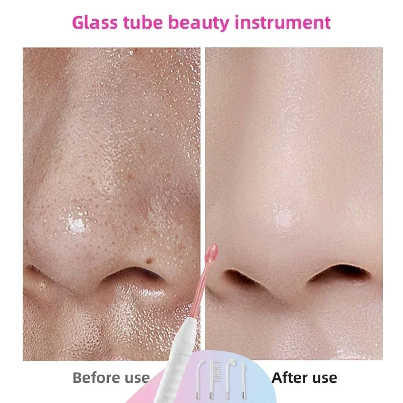 High-frequency Electrotherapy Glass Tube for Acne Removal and Spot Refinement Skin Hydrotherapy Facial Treatment Device 5