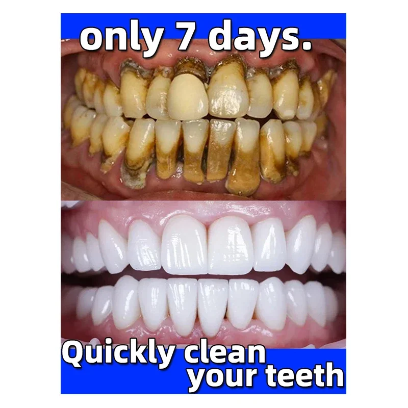 Dental Calculus Remover Toothpaste Wipe Off Plaque Stain Herbal Fresh Breath Teeth Whitening 100g