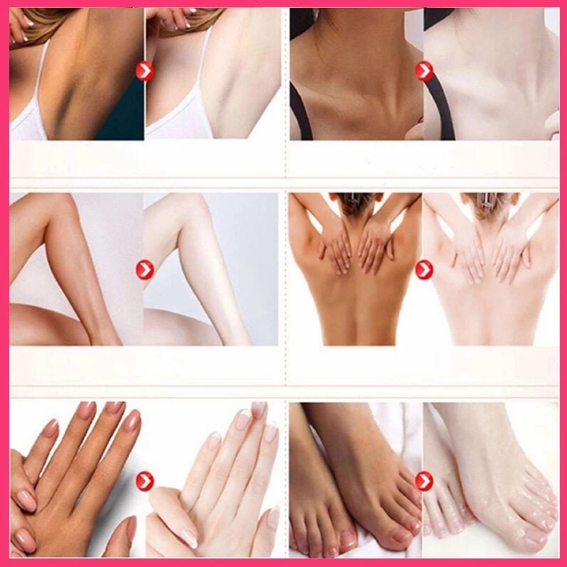 MAYCHEER Body Whitening Darkening Cream Underarms Arms Knees Darkening Moisturising Fine Skin whitening body cream whitening cream body lotion moisturising lotion brightening cream brightening body cream body care body skin care cream underarm cream