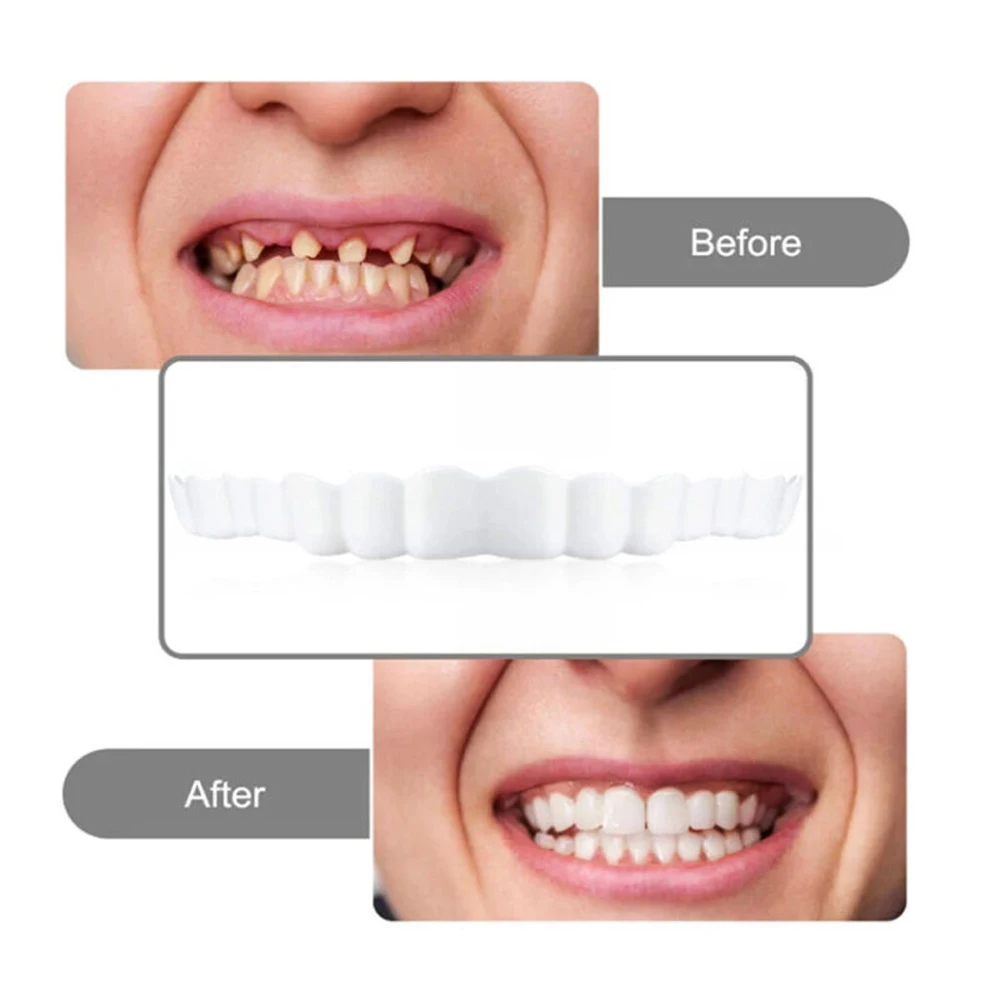 Dentures Teeth Protect Tooth Cover 2 Pairs for Men and Women