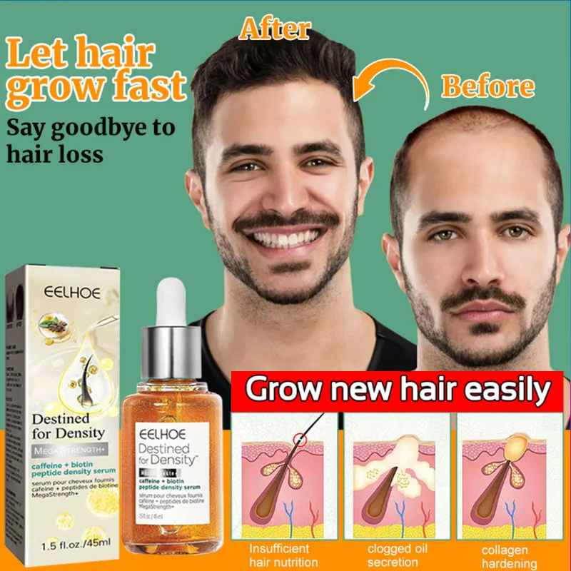 Buy KURAIY pure ONION OIL Anti Hair Fall Treatment Hair Growth Essence Oil  Scalp Massage Moisturizing Thick Hair Nutrition Spray 50 ML Online at Best  Prices in India - JioMart.