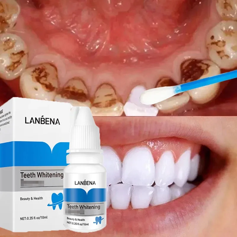 LANBENA Teeth Whitening Liquid Remove Plaque Tooth Stains Clean Oral