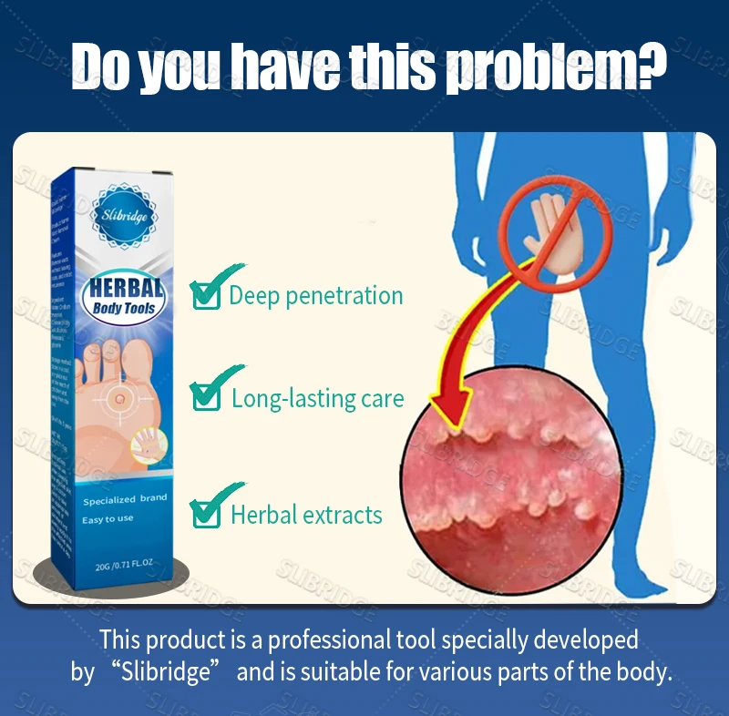 Flacone blu sicuro ed efficace per rimuovere le verruche, strumenti per il corpo, congelamento delle verruche._voghion.com