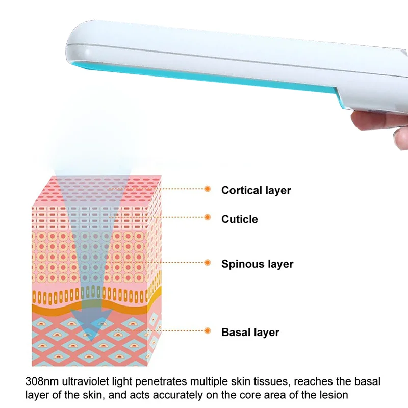 311nm Uvb Vitiligo Large Area Household White Spot Psoriasis uvb Narrow Spectrum Ultraviolet Therapeutic Apparatus
