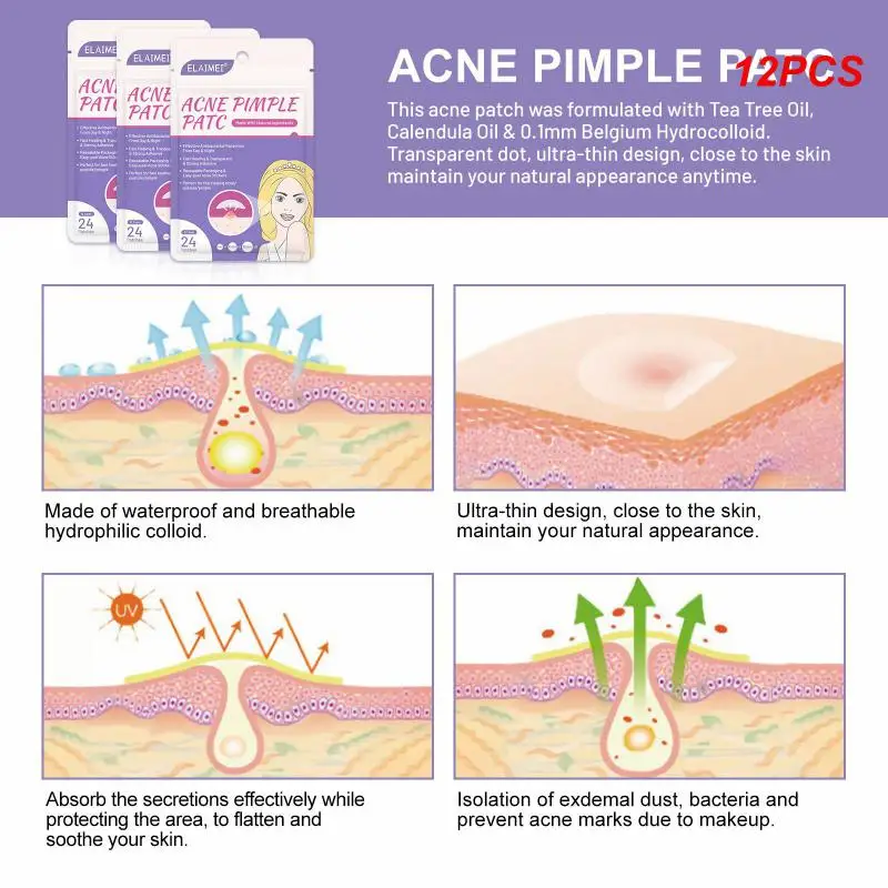 

/Упаковка пластырей от акне и ночных невидимых наклеек для акне, лечение прыщей, гидроколлоидная наклейка для акне, инструмент для ухода за кожей