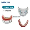 Dental Teeth Model with Implant Overdenture Inferior Demo Mandibular Model Dentist Student Learning Model 2