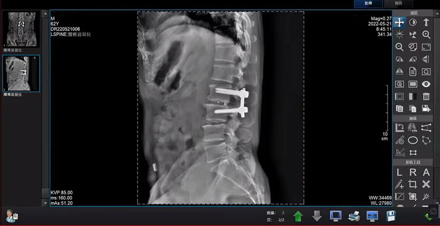 Рисунок 5 - Iray Mars 1417V беспроводной медицинский