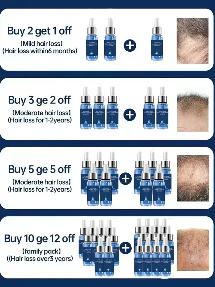 Hair Care Oil Nourish Hair for Men Women Ginger Natural Anti Loss Scalp Serum