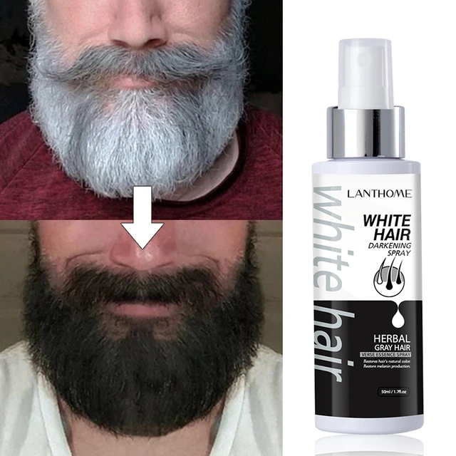 Aggregate 147+ beard white hair treatment super hot dedaotaonec