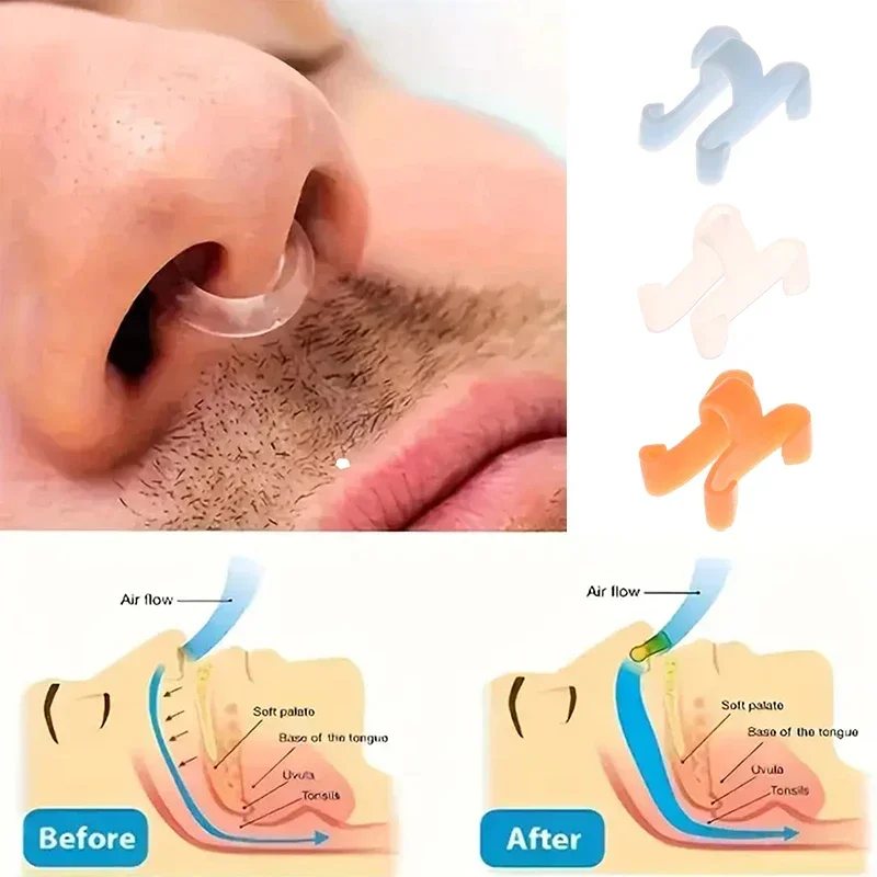 4/8Pcs Reusable Snoring Device Enjoy A Peaceful Night Sleep Anti Snoring Breathe Easy Sleep Aid Nose Clip Nasal Dilators Device