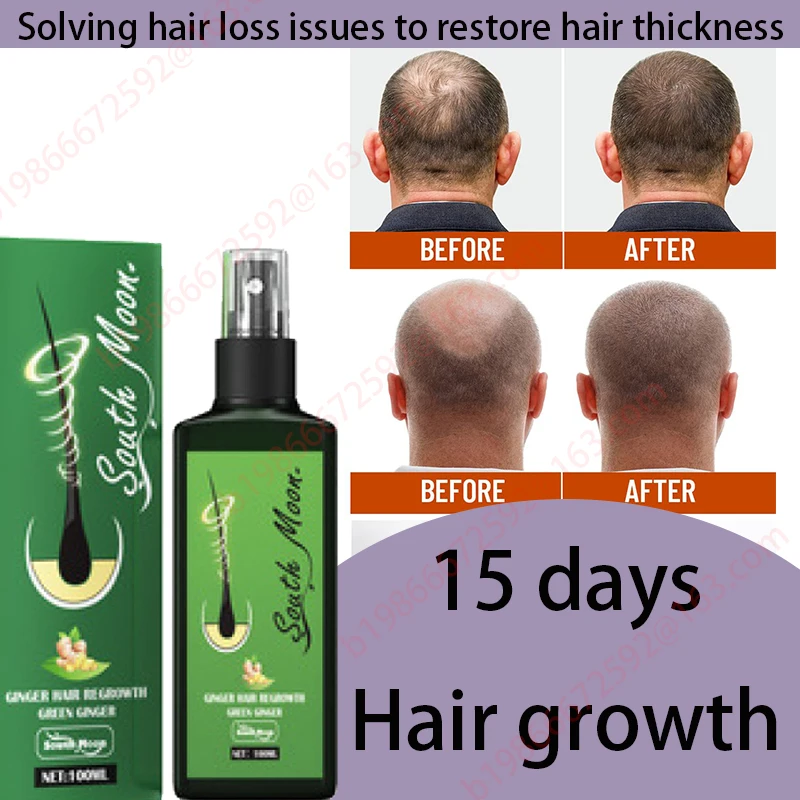 

Strong Effect Hair Growth Products Ginger Essential Oil 2 Week Treat Hair Loss Scalp Repair Nourish Hair Roots Regrowth
