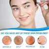 B5 Hyaluronic Acid Serum Facial Anti A-ging W-rinkle Lift Firming Fine Lines Lightening Dark Circle Skin Brightening Hyalu Serum 3