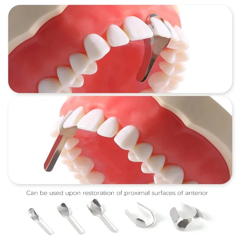 Dental Proximal Anterior Strips 30pcs/box Large Small Twin Anterior Matrices Matrix Systems NICEDEN