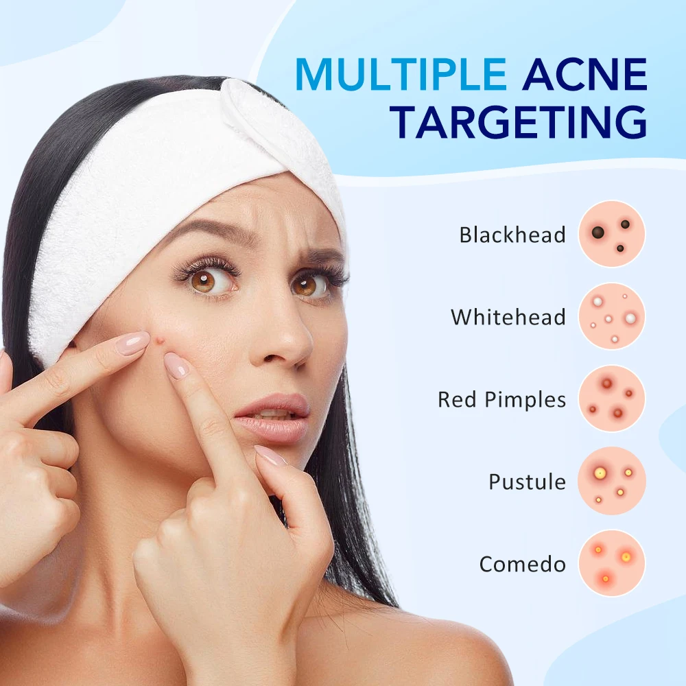 180-540PCS Invisible Hydrocolloid Pimple Acne Patches 2 Sizes Covering Zit Spot Stickers Mild Pimple Patch For All Skin Types