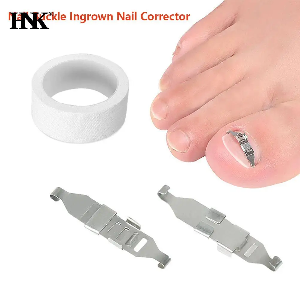 

2Pcs/set Ingrown Toenail Corrector Tools Pedicure Recover Embed Toe Nail Treatment Professional Ingrown Toenail Correction Foot