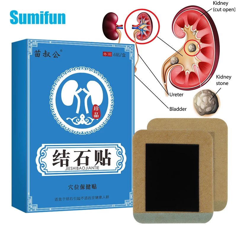 6/18Pcs Remove Kidney Stone Plaster Gallstones Treatment Patch