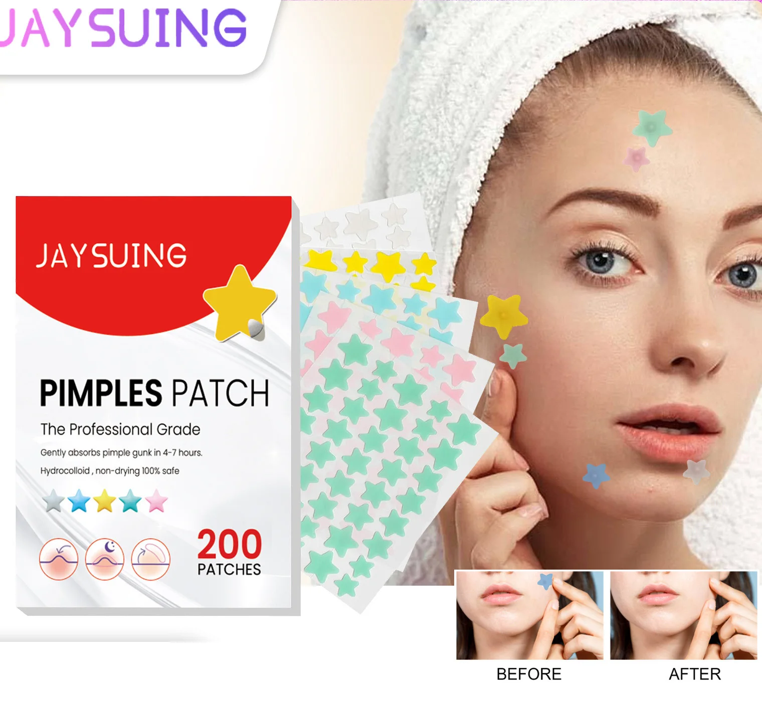 200pcs Acne Pimple Patch Sticker Waterproof Acne Treatment Pimple Remover Tool Blemish Spot Facial Mask Skin Care Hidden Pimple 400 200 100 50 шт 25 50 100 200pcs foot patch