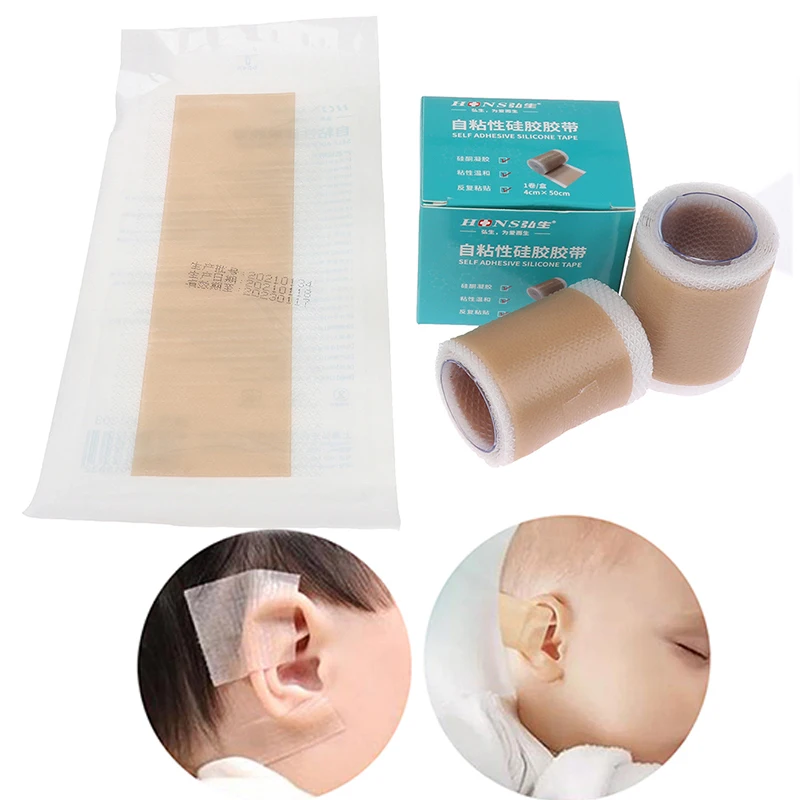 Description Picture 2 of item1pcs Baby Pinna Valgus Ear Correctors Breathing Patch Medical Silicone Tape Infant Ear Correction Patch Stickers