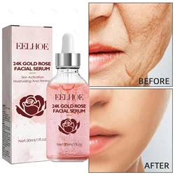 24k Gold Rose Facial Serum Hyaluronic Acid Moisturizing Whitening Dark Spots Remover Brighten Fade Fine Line Essence Skin Care