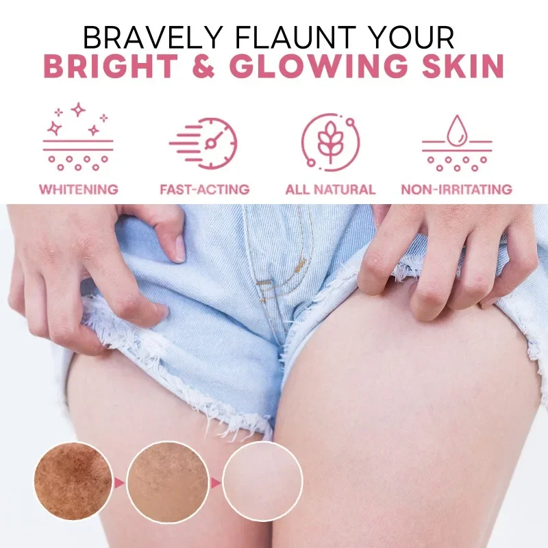 Body Whitening Cream Lighten Thigh Inner Joint Dark Melanin Remove Underarm Knee Elbow Bleach Private Parts Brighten