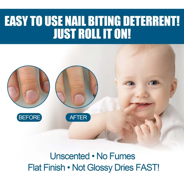 Update more than 127 nail biting deterrent device best ceg.edu.vn