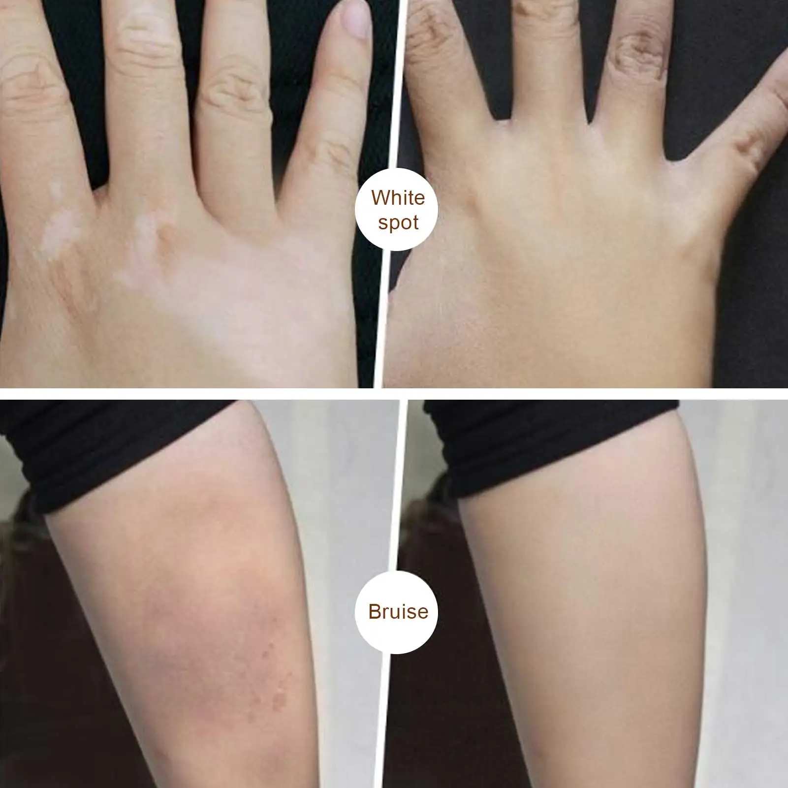 Waterproof Tattoo Concealer Makeup Body Birthmark Scar Spots Cover Cream 10g x 2pcs