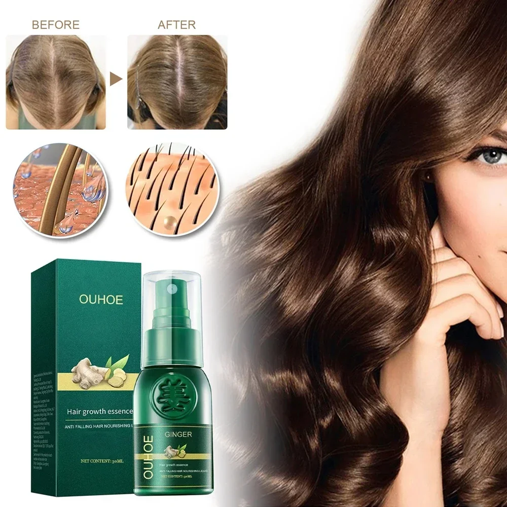 Ginger Hair Growth Sprays Products Fast Grows Nourish Damaged Hair Care Natural Anti Loss Serum Prevent Baldness Treatment