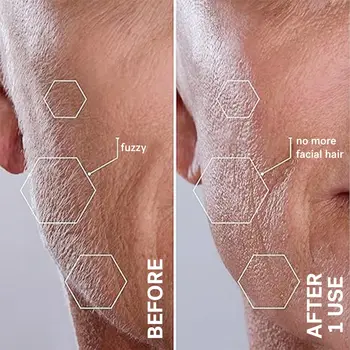 Sonic Smooth Dermaplane Razor for Women - Face & Eyebrow Trimmer, Peach Fuzz Remover with 8 Weeks of Blades 5