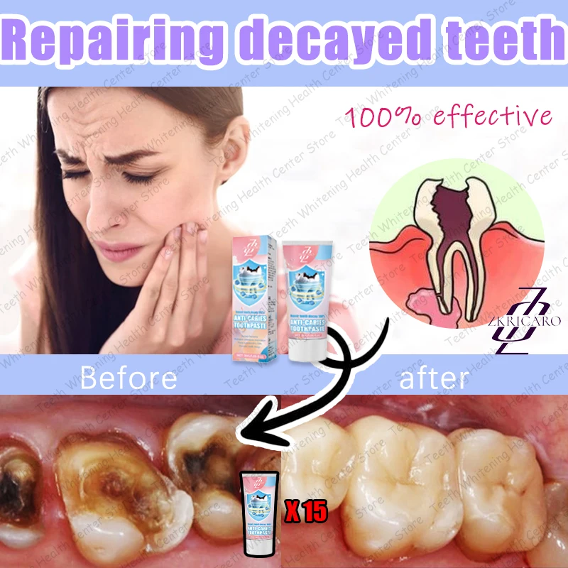 Tooth Decay Repair New Technology Efficient Repair of Tooth Decay