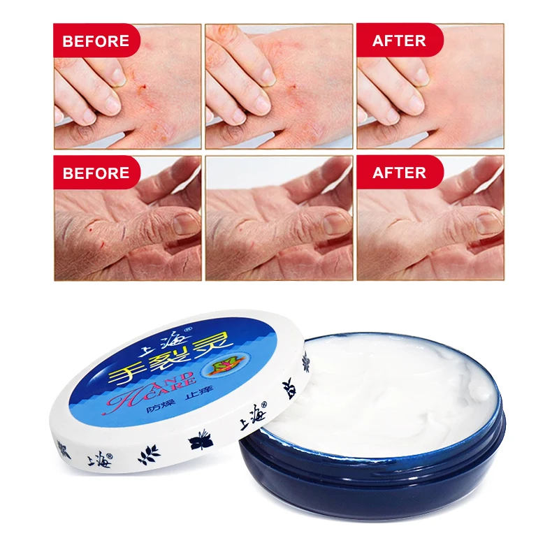 

Shanghai Beauty Chapped Skin Hand Care Nourishes Hands Roughness And Craze In Hands Caused By Cold & Dry Weather Or Daily Work