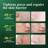 MABREM Pore Shrinking Serum Essence Pores Treatment Moisturizing Relieve Dryness Oil-Control Firming Repairing Smooth Skin Care 2