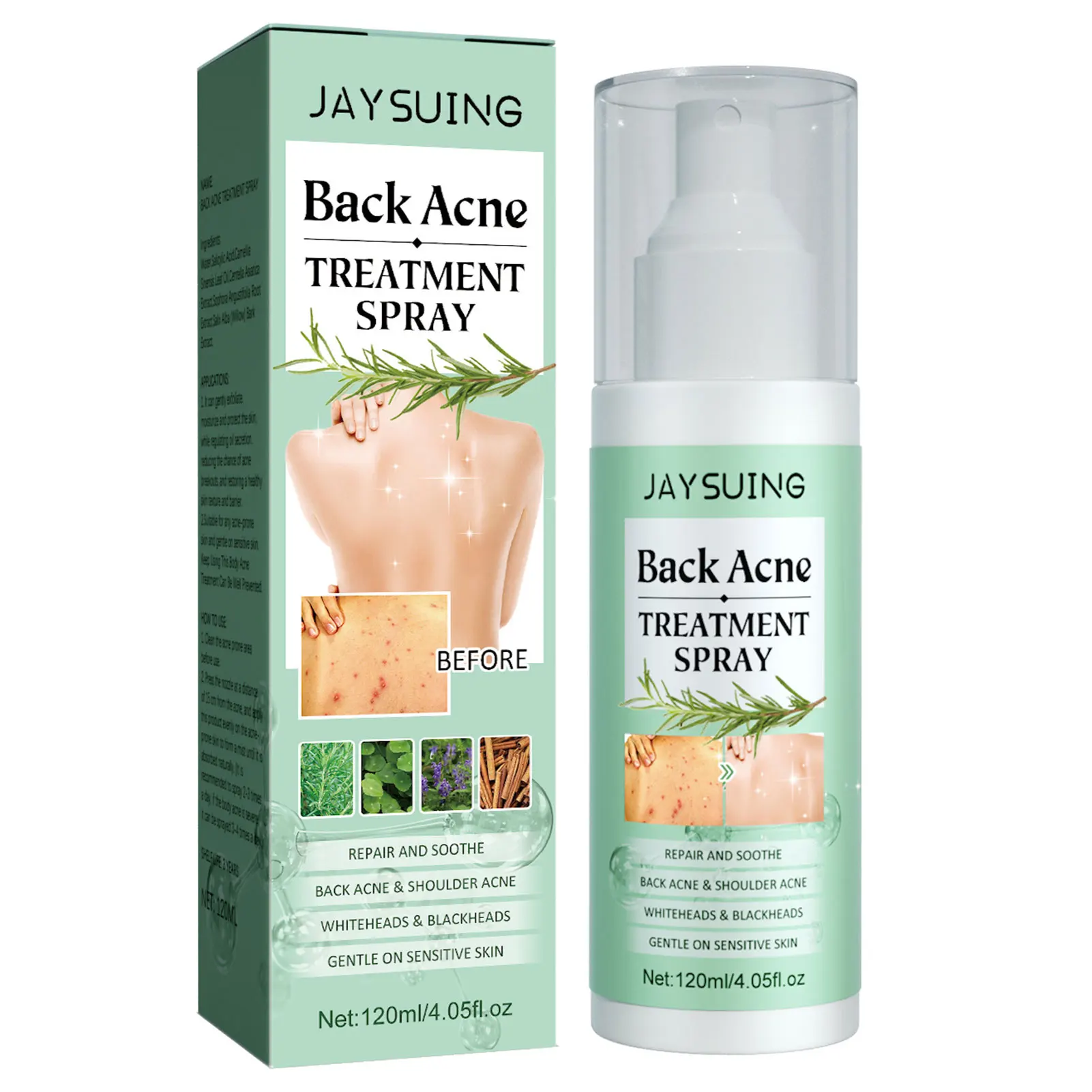 

Back Acne Repair Spray Comfortable Using Lightweight Serum for People Skin Health Care