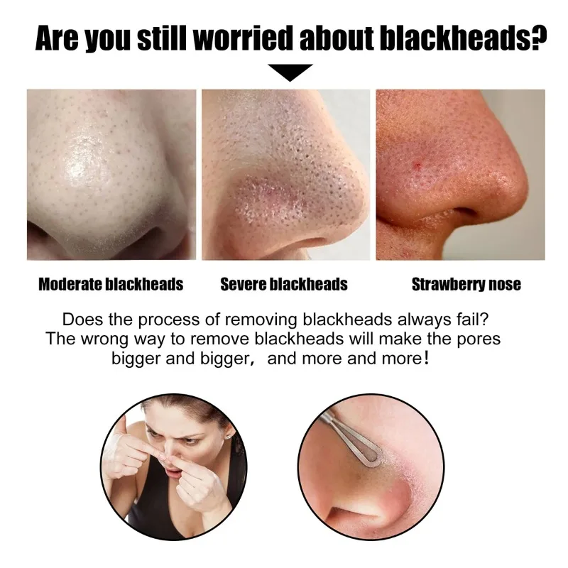 Blackhead  Nose  Patch  for  Deep  Cleansing  -  Quickly  Removes  Blackheads  &  Facial Spots ,  Restores  Fresh  Skin
