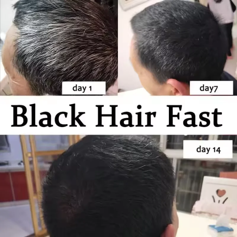 Copertura del siero per il trattamento dei capelli bianchi grigi Capelli bianchi al spray riparatore del colore naturale nero Anti perdita dei capelli Ripristina la salute - immagine 2