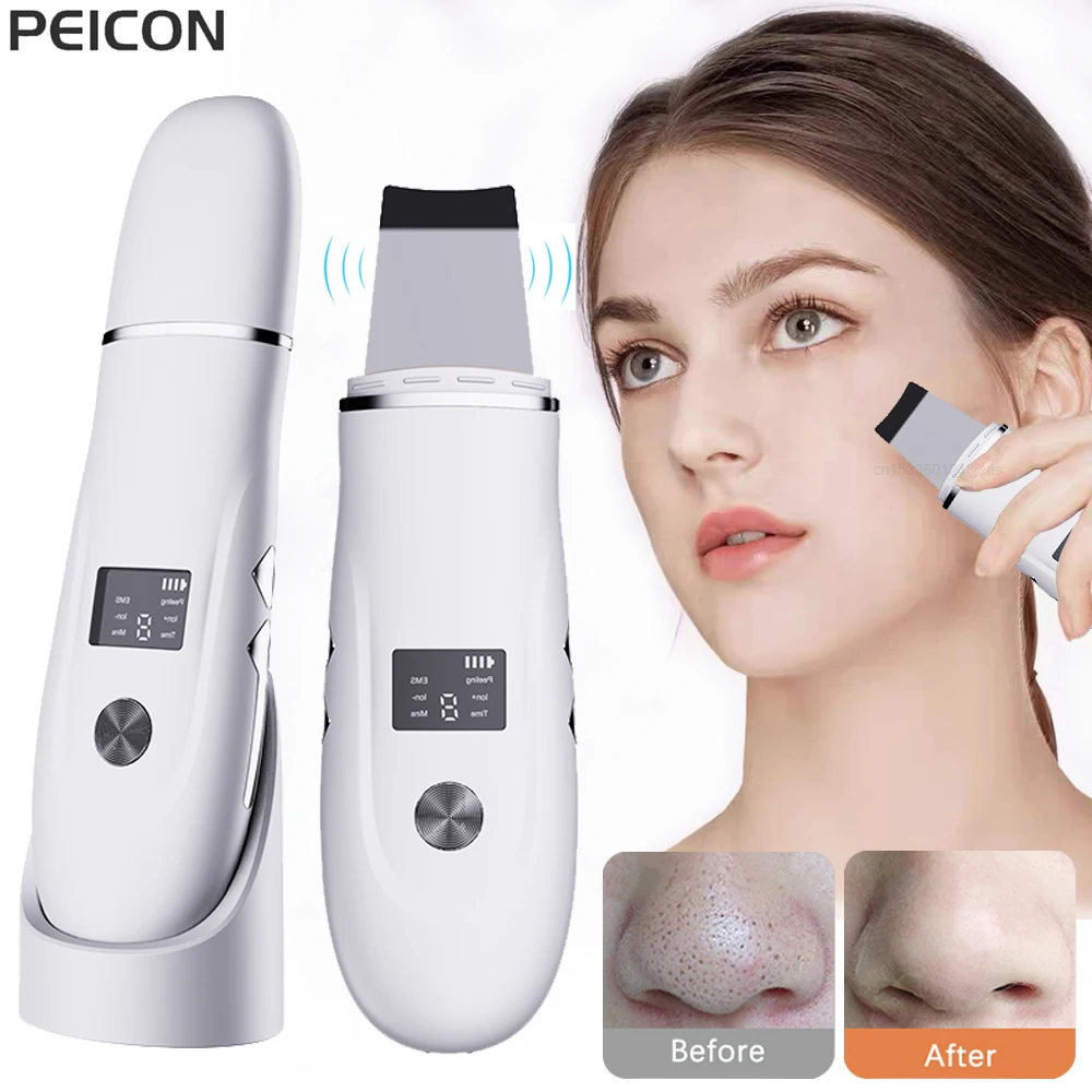 UltrasonicSkinScrubberBlackheadRemoverUltrasonicPeelingPore
