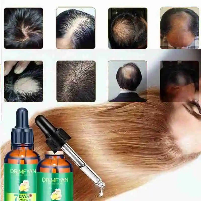 Ginger Essence Hair Loss Treatment Repair Nourish Hair Roots Scalp Care Essence Products For Men Women 30ml