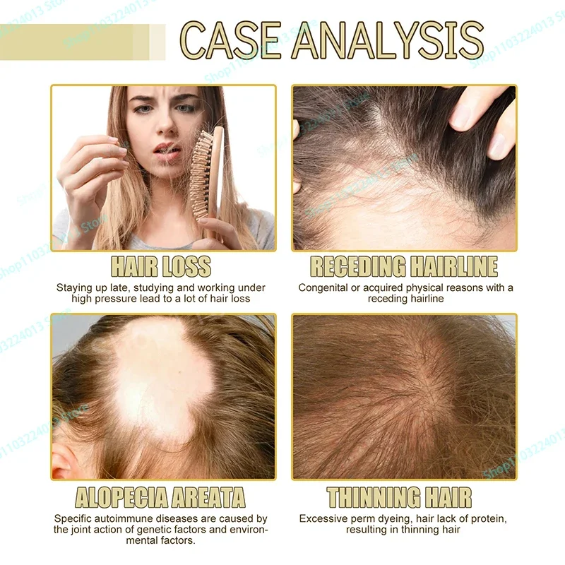 

Hair Growth Products Prevent Hair Loss Essential Oil Fast Growing Anti-Drying Scalp Treatment Repair Beauty Health for Men Women