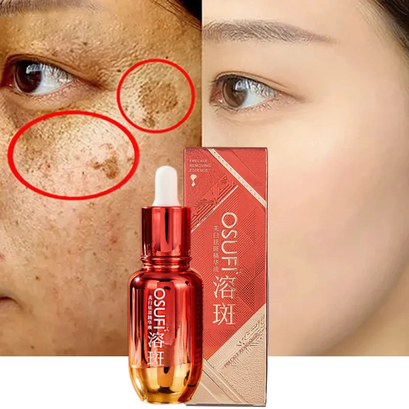 Freckle Removing Whitening Face Serum Black Spot Melasma Remover Reduce Pigmentation Moisturizing Brightening Skin Care 50ml lanthome glutathione whitening serum fade black dark spots vitamin c defects reduce facial oil brightening firming for women