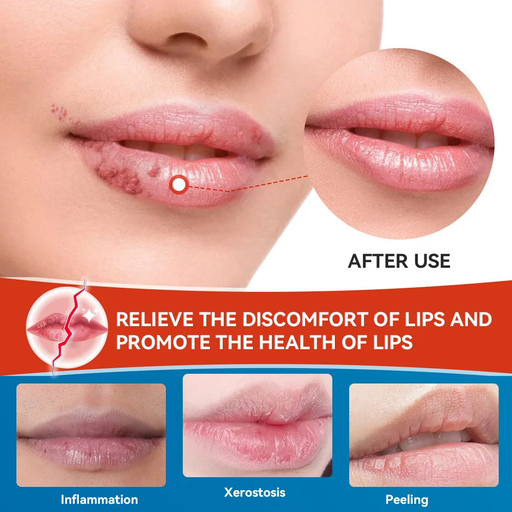 Mouth care,lip gloss,Makeup,make up,Lipstick, Cross border Lipitis Cream Lip Care Skin Topical Cream