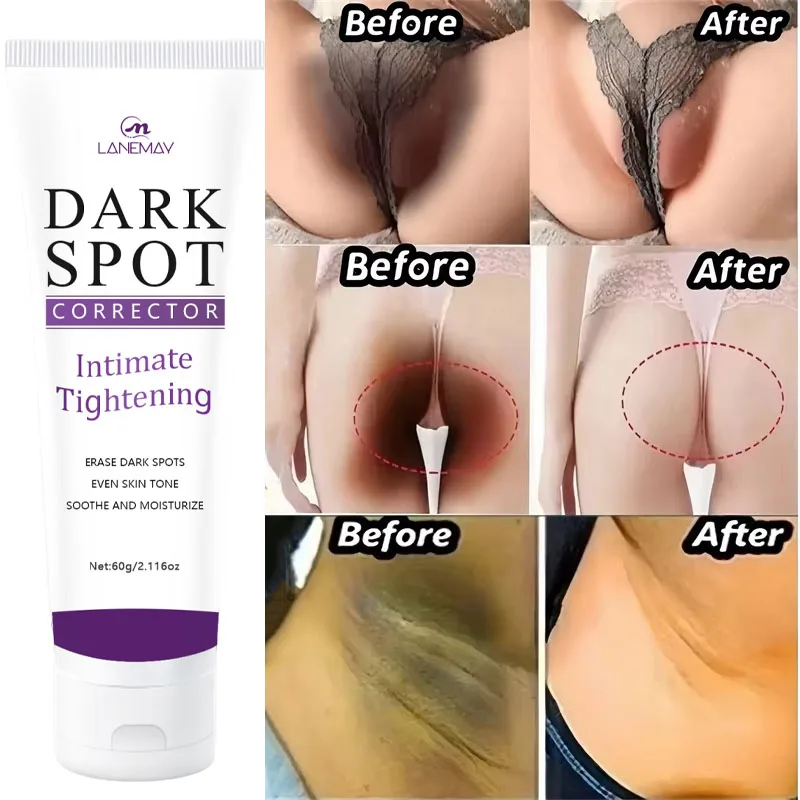Body Lotion Cream Whitening Private Parts Underarm Butt Knee Inner Thigh Intimate Parts Remove Melanin