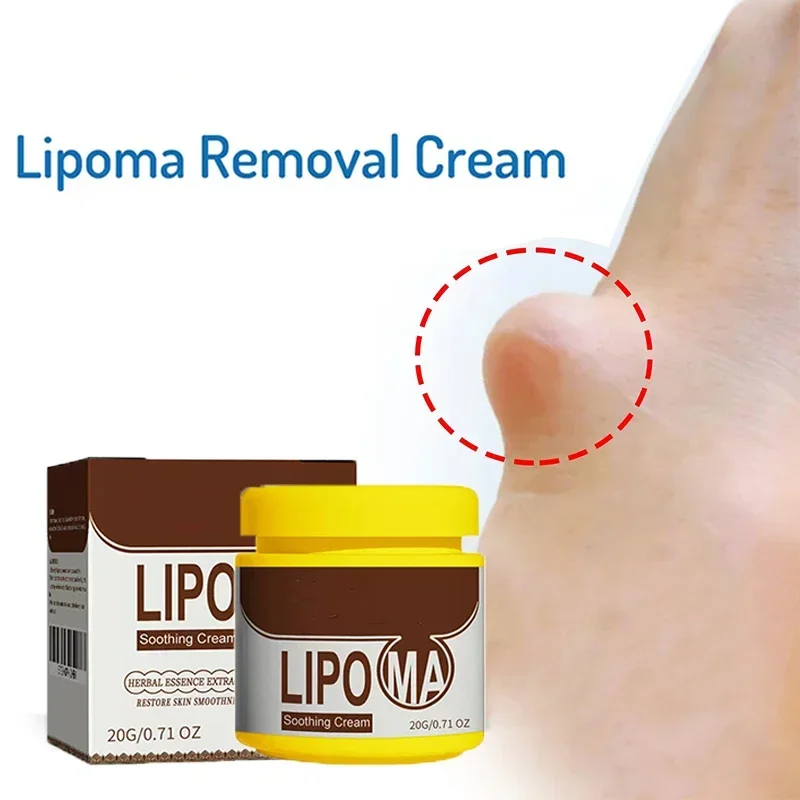 Soothing Cream Subcutaneous Lumps Remover cream lumps remover