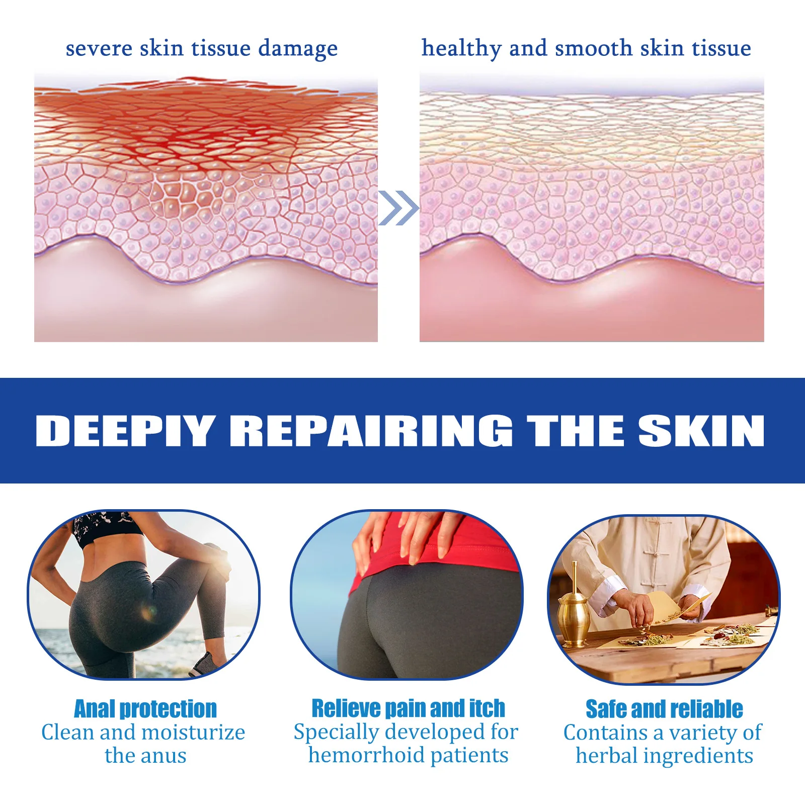 Hemorrhoids Capsules Natural Herbs Care Constipation And Hemorrhoids