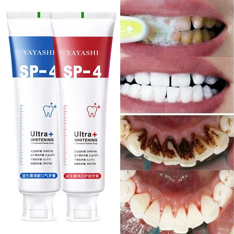 Probiotic Toothpaste 120g Remove Plaque Stains Teeth Whitener Sp-4 Whitening Tooth Oral Hygiene Clean Fresh Breath Dental Tools teeth whitening essence,teeth whitening product,teeth health product