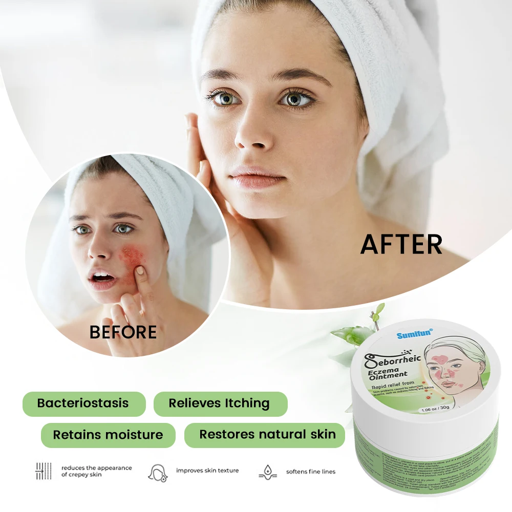 Sumifun Seborrheic Eczema Ointment Anti-Inflammatory Dermatitis Inhibiting Bacteria Cream Skin Itching Medical Plaster 1/3/5Pcs