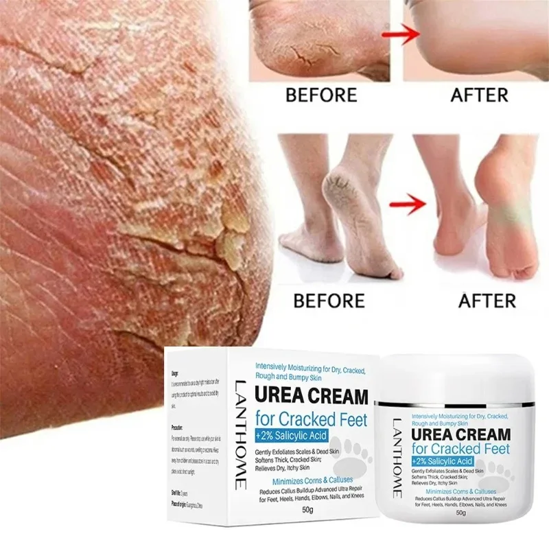 

40% Foot Urea Cream Foot Peeling Spray Scrub Exfoliating Cream Heel Cracked Repair Cream Removal Dead Skin Hand Feet Care