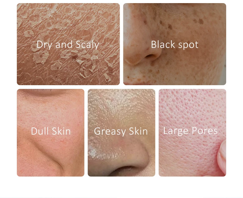Beauty Skin Care Set - Whitening Cream Face Cleaning Glowing Moisturizr Dark Skin Serum Anti Wrinkle Facial Products Kits Vitamins